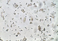 Amixin