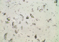 Gidazepam